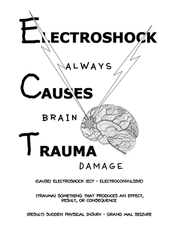 Electroshock Always Causes Trauma